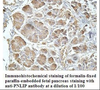 PNLIP / PL / Pancreatic Lipase Antibody
