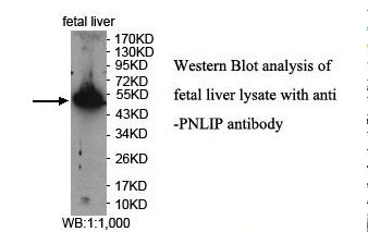 PNLIP / PL / Pancreatic Lipase Antibody