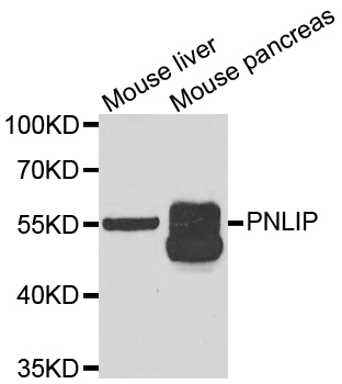 PNLIP / PL / Pancreatic Lipase Antibody - Western blot analysis of extracts of various cell lines.