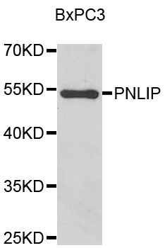 PNLIP / PL / Pancreatic Lipase Antibody - Western blot analysis of BxPC3 cell lysate.