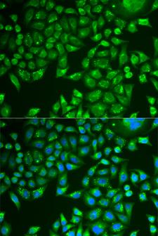 PNLIP / PL / Pancreatic Lipase Antibody - Immunofluorescence analysis of U2OS cells.