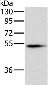 PNLIP / PL / Pancreatic Lipase Antibody - Western blot analysis of Mouse pancreas tissue, using PNLIP Polyclonal Antibody at dilution of 1:400.