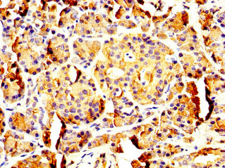 PNLIP / PL / Pancreatic Lipase Antibody - Immunohistochemistry image at a dilution of 1:200 and staining in paraffin-embedded human pancreatic tissue performed on a Leica BondTM system. After dewaxing and hydration, antigen retrieval was mediated by high pressure in a citrate buffer (pH 6.0) . Section was blocked with 10% normal goat serum 30min at RT. Then primary antibody (1% BSA) was incubated at 4 °C overnight. The primary is detected by a biotinylated secondary antibody and visualized using an HRP conjugated SP system.
