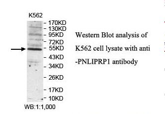 PNLIPRP1 Antibody