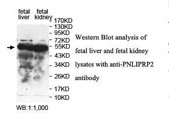 PNLIPRP2 Antibody