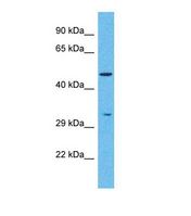 PNLIPRP2 Antibody - Western blot of Human Stomach Tumor. PNLIPRP2 antibody dilution 1.0 ug/ml.  This image was taken for the unconjugated form of this product. Other forms have not been tested.