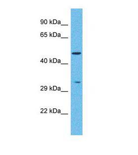 PNLIPRP2 Antibody - Western blot of Human Stomach Tumor. PNLIPRP2 antibody dilution 1.0 ug/ml.  This image was taken for the unconjugated form of this product. Other forms have not been tested.