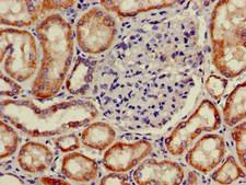 PNLIPRP2 Antibody - Immunohistochemistry of paraffin-embedded human kidney tissue at dilution of 1:100