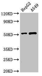 PNLIPRP2 Antibody - Western Blot Positive WB detected in:HepG2 whole cell lysate,A549 whole cell lysate All Lanes:PNLIPRP2 antibody at 3µg/ml Secondary Goat polyclonal to rabbit IgG at 1/50000 dilution Predicted band size: 52 KDa Observed band size: 52 KDa