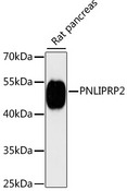 PNLIPRP2 Antibody - Western blot analysis of extracts of rat pancreas, using PNLIPRP2 antibody at 1:3000 dilution. The secondary antibody used was an HRP Goat Anti-Rabbit IgG (H+L) at 1:10000 dilution. Lysates were loaded 25ug per lane and 3% nonfat dry milk in TBST was used for blocking. An ECL Kit was used for detection and the exposure time was 90s.