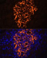 PNLIPRP2 Antibody - Immunofluorescence analysis of Rat pancreas using PNLIPRP2 Polyclonal Antibody at dilution of 1:100.Blue: DAPI for nuclear staining.