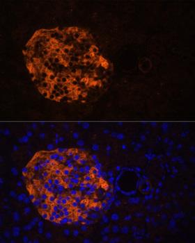 PNLIPRP2 Antibody - Immunofluorescence analysis of Mouse pancreas using PNLIPRP2 Polyclonal Antibody at dilution of 1:100.Blue: DAPI for nuclear staining.
