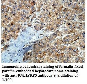 PNLIPRP3 Antibody
