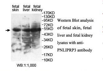 PNLIPRP3 Antibody