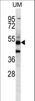 PNLIPRP3 Antibody - PNLIPRP3 Antibody western blot of uterus tumor cell line lysates (35 ug/lane). The PNLIPRP3 antibody detected the PNLIPRP3 protein (arrow).