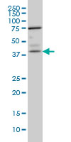 PNMA1 / MA1 Antibody - PNMA1 monoclonal antibody (M01), clone 4G6 Western blot of PNMA1 expression in IMR-32.