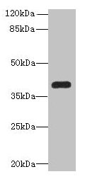 PNMA1 / MA1 Antibody - Western blot All lanes: PNMA1 antibody at 4µg/ml + Mouse brain tissue Secondary Goat polyclonal to rabbit IgG at 1/10000 dilution Predicted band size: 40 kDa Observed band size: 40 kDa
