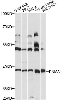 PNMA1 / MA1 Antibody - Western blot analysis of extracts of various cell lines, using PNMA1 antibody at 1:3000 dilution. The secondary antibody used was an HRP Goat Anti-Rabbit IgG (H+L) at 1:10000 dilution. Lysates were loaded 25ug per lane and 3% nonfat dry milk in TBST was used for blocking. An ECL Kit was used for detection and the exposure time was 15s.