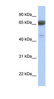 PNMA3 Antibody - PNMA3 antibody Western blot of Fetal Lung lysate. This image was taken for the unconjugated form of this product. Other forms have not been tested.