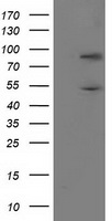 PNMA3 Antibody - HEK293T cells were transfected with the pCMV6-ENTRY control (Left lane) or pCMV6-ENTRY PNMA3 (Right lane) cDNA for 48 hrs and lysed. Equivalent amounts of cell lysates (5 ug per lane) were separated by SDS-PAGE and immunoblotted with anti-PNMA3.