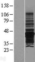 PNMA6A Protein - Western validation with an anti-DDK antibody * L: Control HEK293 lysate R: Over-expression lysate