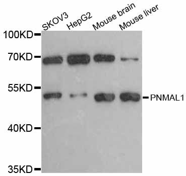 PNMAL1 Antibody - Western blot analysis of extracts of various cell lines, using PNMAL1 antibody at 1:3000 dilution. The secondary antibody used was an HRP Goat Anti-Rabbit IgG (H+L) at 1:10000 dilution. Lysates were loaded 25ug per lane and 3% nonfat dry milk in TBST was used for blocking. An ECL Kit was used for detection and the exposure time was 60s.