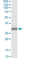 PNMT Antibody - Immunoprecipitation of PNMT transfected lysate using anti-PNMT monoclonal antibody and Protein A Magnetic Bead, and immunoblotted with PNMT rabbit polyclonal antibody.