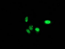 PNMT Antibody - Immunofluorescent staining of HeLa cells using anti-PNMT mouse monoclonal antibody.