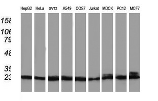 PNMT Antibody - Western blot of extracts (35 ug) from 9 different cell lines by using anti-PNMT monoclonal antibody.