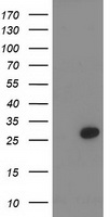 PNMT Antibody - HEK293T cells were transfected with the pCMV6-ENTRY control (Left lane) or pCMV6-ENTRY PNMT (Right lane) cDNA for 48 hrs and lysed. Equivalent amounts of cell lysates (5 ug per lane) were separated by SDS-PAGE and immunoblotted with anti-PNMT.