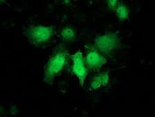 PNMT Antibody - Anti-PNMT mouse monoclonal antibody immunofluorescent staining of COS7 cells transiently transfected by pCMV6-ENTRY PNMT.