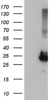 PNMT Antibody - HEK293T cells were transfected with the pCMV6-ENTRY control (Left lane) or pCMV6-ENTRY PNMT (Right lane) cDNA for 48 hrs and lysed. Equivalent amounts of cell lysates (5 ug per lane) were separated by SDS-PAGE and immunoblotted with anti-PNMT.