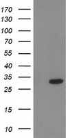 PNMT Antibody - HEK293T cells were transfected with the pCMV6-ENTRY control (Left lane) or pCMV6-ENTRY PNMT (Right lane) cDNA for 48 hrs and lysed. Equivalent amounts of cell lysates (5 ug per lane) were separated by SDS-PAGE and immunoblotted with anti-PNMT.