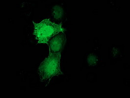 PNMT Antibody - Anti-PNMT mouse monoclonal antibody immunofluorescent staining of COS7 cells transiently transfected by pCMV6-ENTRY PNMT.