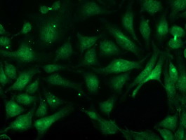 PNMT Antibody - Immunofluorescent staining of HeLa cells using anti-PNMT mouse monoclonal antibody.