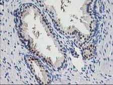 PNMT Antibody - IHC of paraffin-embedded Human prostate tissue using anti-PNMT mouse monoclonal antibody.