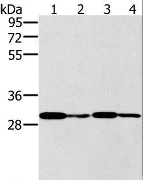 PNMT Antibody - Western blot analysis of K562 cell and human liver cancer tissue, Jurkat and A549 cell, using PNMT Polyclonal Antibody at dilution of 1:400.