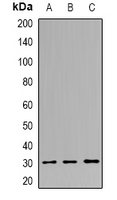PNMT Antibody - Western blot analysis of PNMTase expression in K562 (A); mouse liver (B); mouse heart (C) whole cell lysates.