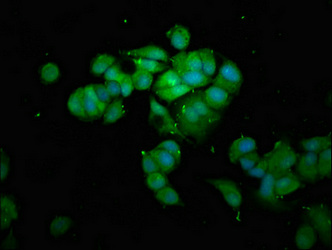 PNMT Antibody - Immunofluorescence staining of MCF-7 cells at a dilution of 1:133, counter-stained with DAPI. The cells were fixed in 4% formaldehyde, permeabilized using 0.2% Triton X-100 and blocked in 10% normal Goat Serum. The cells were then incubated with the antibody overnight at 4 °C.The secondary antibody was Alexa Fluor 488-congugated AffiniPure Goat Anti-Rabbit IgG (H+L) .