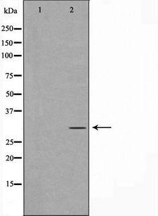 PNMT Antibody - Western blot analysis of HepG2 whole cells lysates using PNMT antibody. The lane on the left is treated with the antigen-specific peptide.