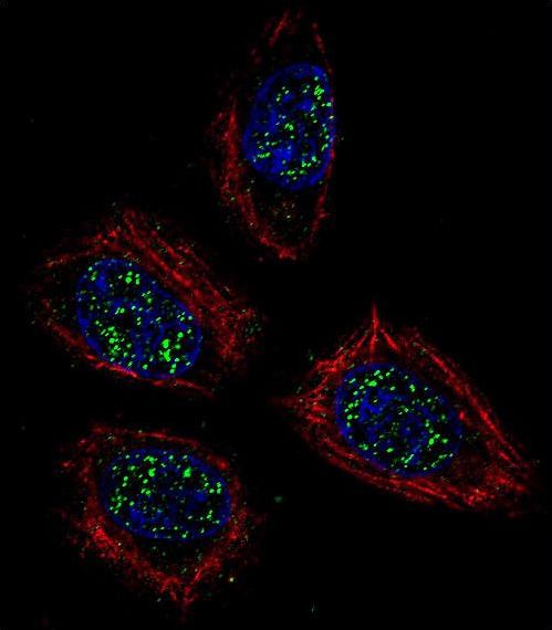 PNN / Pinin Antibody - Confocal immunofluorescence of PNN Antibody with NCI-H460 cell followed by Alexa Fluor 488-conjugated goat anti-rabbit lgG (green). Actin filaments have been labeled with Alexa Fluor 555 phalloidin (red). DAPI was used to stain the cell nuclear (blue).