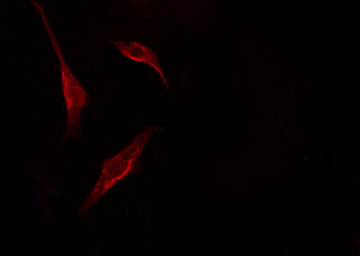 PNN / Pinin Antibody - Staining HT29 cells by IF/ICC. The samples were fixed with PFA and permeabilized in 0.1% Triton X-100, then blocked in 10% serum for 45 min at 25°C. The primary antibody was diluted at 1:200 and incubated with the sample for 1 hour at 37°C. An Alexa Fluor 594 conjugated goat anti-rabbit IgG (H+L) antibody, diluted at 1/600, was used as secondary antibody.