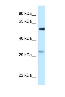 PNO1 Antibody - PNO1 antibody Western blot of HeLa Cell lysate. Antibody concentration 1 ug/ml.  This image was taken for the unconjugated form of this product. Other forms have not been tested.