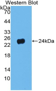 PNOC / Nociceptin Antibody - Western blot of recombinant PNOC / Nociceptin.