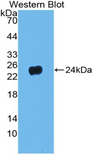 PNOC / Nociceptin Antibody - Western blot of recombinant PNOC / Nociceptin.