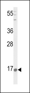 PNOC / Nociceptin Antibody - Western blot of PNOC Antibody in HepG2 cell line lysates (35 ug/lane). PNOC (arrow) was detected using the purified antibody.