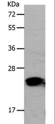 PNOC / Nociceptin Antibody - Western blot analysis of Human liver cancer tissue, using PONC Polyclonal Antibody at dilution of 1:1200.