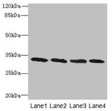 PNP / Nucleoside Phosphorylase Antibody - Western blot All lanes: Purine nucleoside phosphorylase antibody at 16µg/ml Lane 1: Jurkat whole cell lysate Lane 2: K562 whole cell lysate Lane 3: U937 whole cell lysate Lane 4: 293T whole cell lysate Secondary Goat polyclonal to rabbit IgG at 1/10000 dilution Predicted band size: 32 kDa Observed band size: 32 kDa