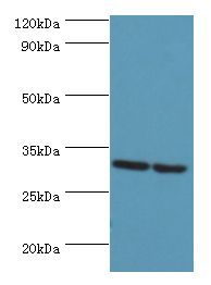 PNP / Nucleoside Phosphorylase Antibody - Western blot. All lanes: PNP antibody at 10 ug/ml. Lane 1: Jurkat whole cell lysate. Lane 2: k562 whole cell lysate. Secondary antibody: Goat polyclonal to rabbit at 1:10000 dilution. Predicted band size: 32 kDa. Observed band size: 32 kDa.