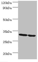 PNP / Nucleoside Phosphorylase Antibody - Western blot All lanes: PNP antibody at 10µg/ml Lane 1: Jurkat whole cell lysate Lane 2: K562 whole cell lysate Secondary Goat polyclonal to rabbit IgG at 1/10000 dilution Predicted band size: 32 kDa Observed band size: 32 kDa